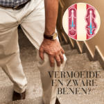 Man die zijn knie vasthoudt op een trap met illustratie van bloedcirculatie en tekst over vermoeide en zware benen.