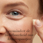 Close-up van de huid rond het oog met crème, met tekst helpt de zichtbaarheid van kraaienpootjes te verminderen.