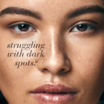 Close-up of skin with text Struggling with dark spots?