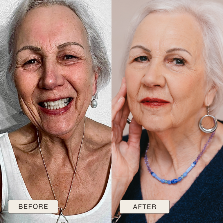 Testimonial Antoinette, Before and after pictures after use of Natural Magic Skin Care range