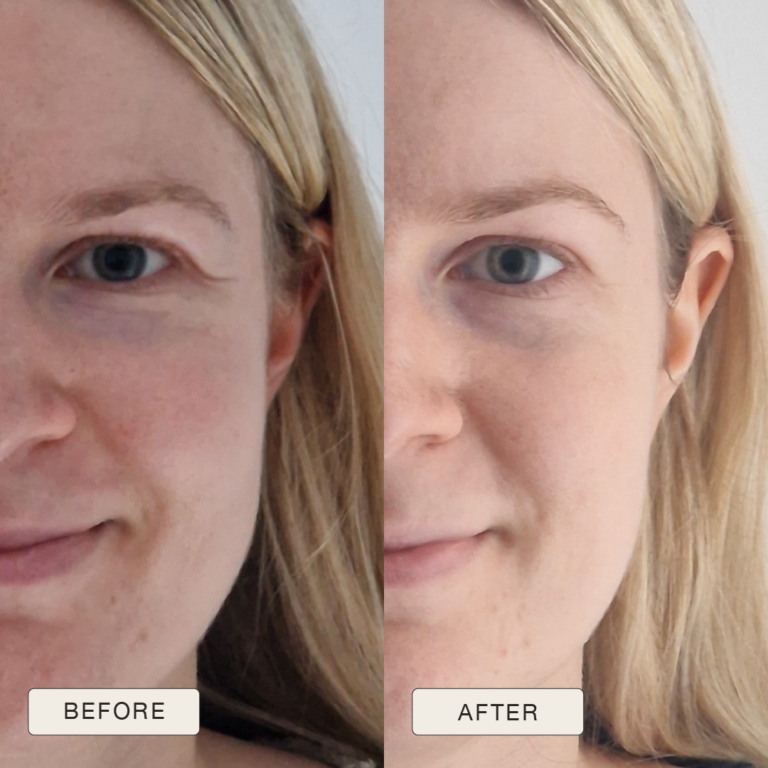 Testimonial Celine, Before and after pictures after use of Natural Magic Skin Care range