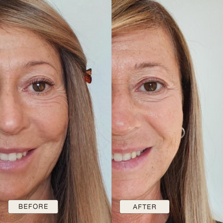 Testimonial Rosanna, Before and after pictures after use of Natural Magic Skin Care range